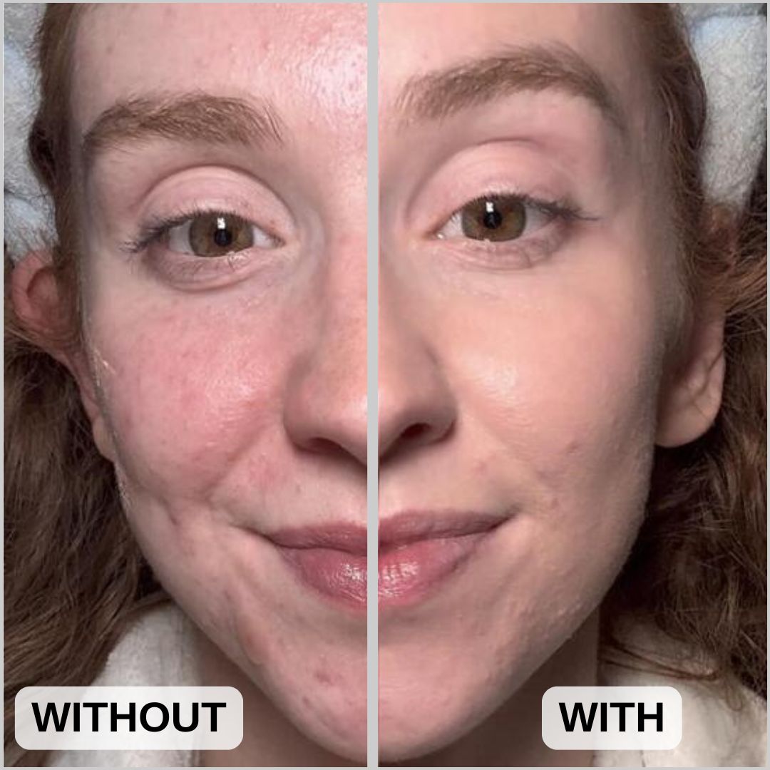 Organic Tinted Face Moisturizer + SPF 30 β 9 Ingredients β No White Cast β Daily Mineral Protection β 2 oz