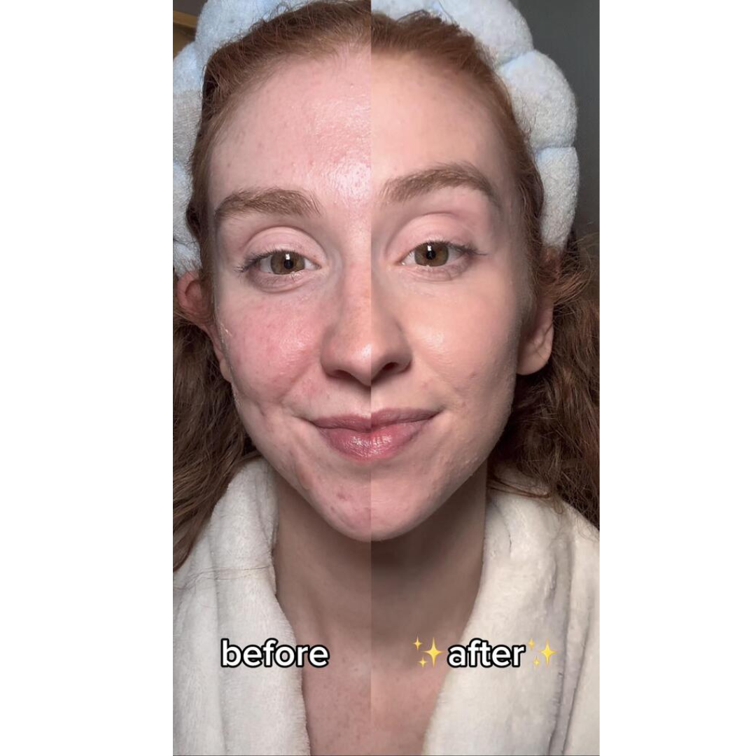 Tinted Sunscreen and Organic Moisturizer β 9 Ingredients β No White Cast β Face-Safe Daily SPF β 2 oz